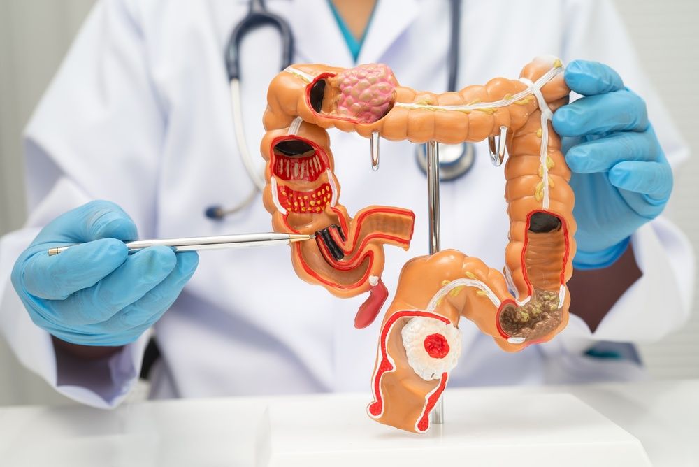 Especialista en cáncer de colon en Querétaro explicando la cirugía de colon a su paciente