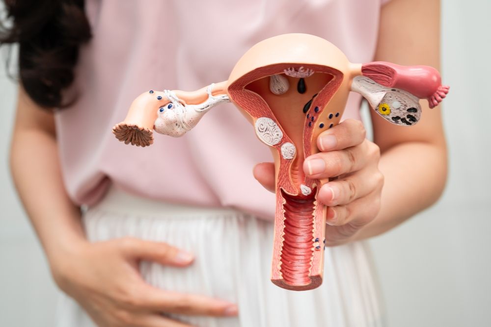 Cáncer de endometrio — Dr. Aldo Olvera Casas, Querétaro